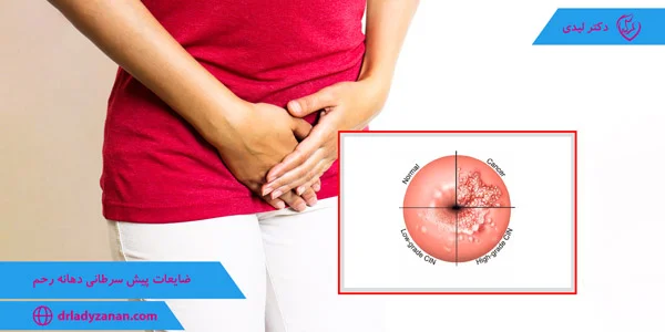 Precancerous-lesions-of-the-cervix