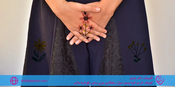 Shrinking-the-labia-without-surgery-A-new-solution-to-fix-labia-majora