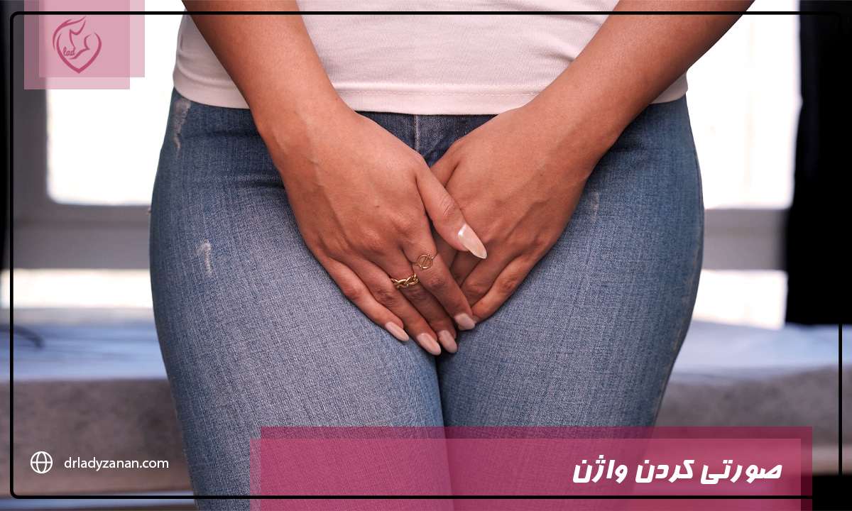 صورتی کردن واژن