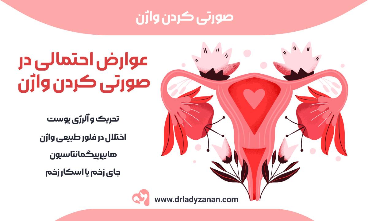 صورتی کردن واژن