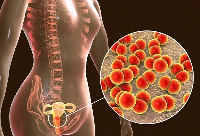 What-doctor-should-we-see-sexually-transmitted-diseases