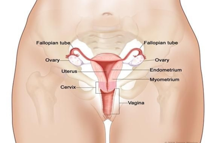 برای زخم دهانه رحم چه دارویی استفاده کنم